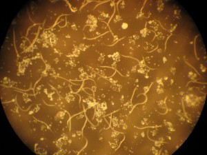 Fadenwürmer (Nematoden) durch ein Mikroskop betrachtet.
